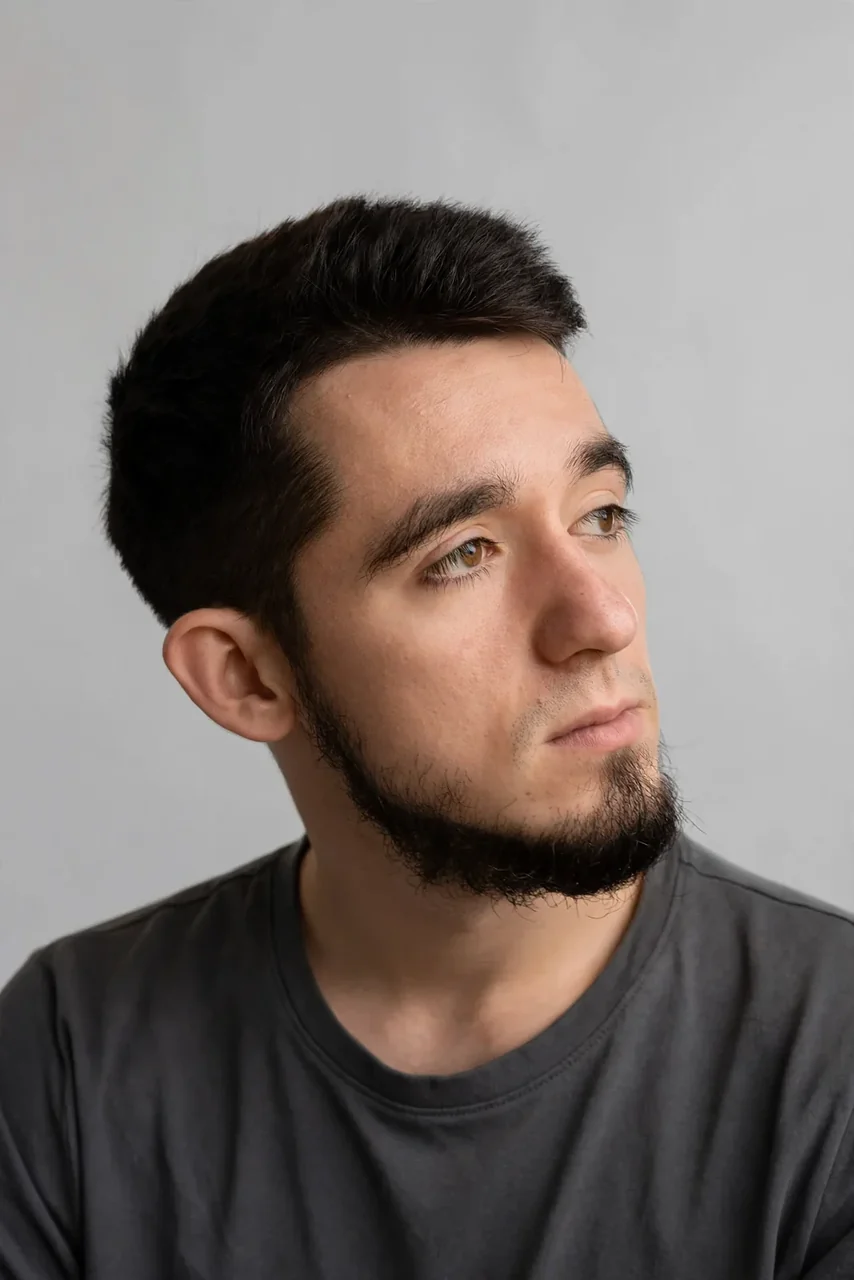 Before: Beard transplant · cheeks
