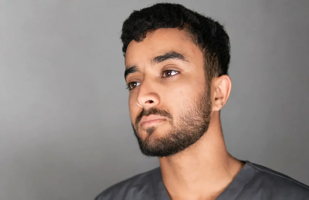 After: Beard transplant · density