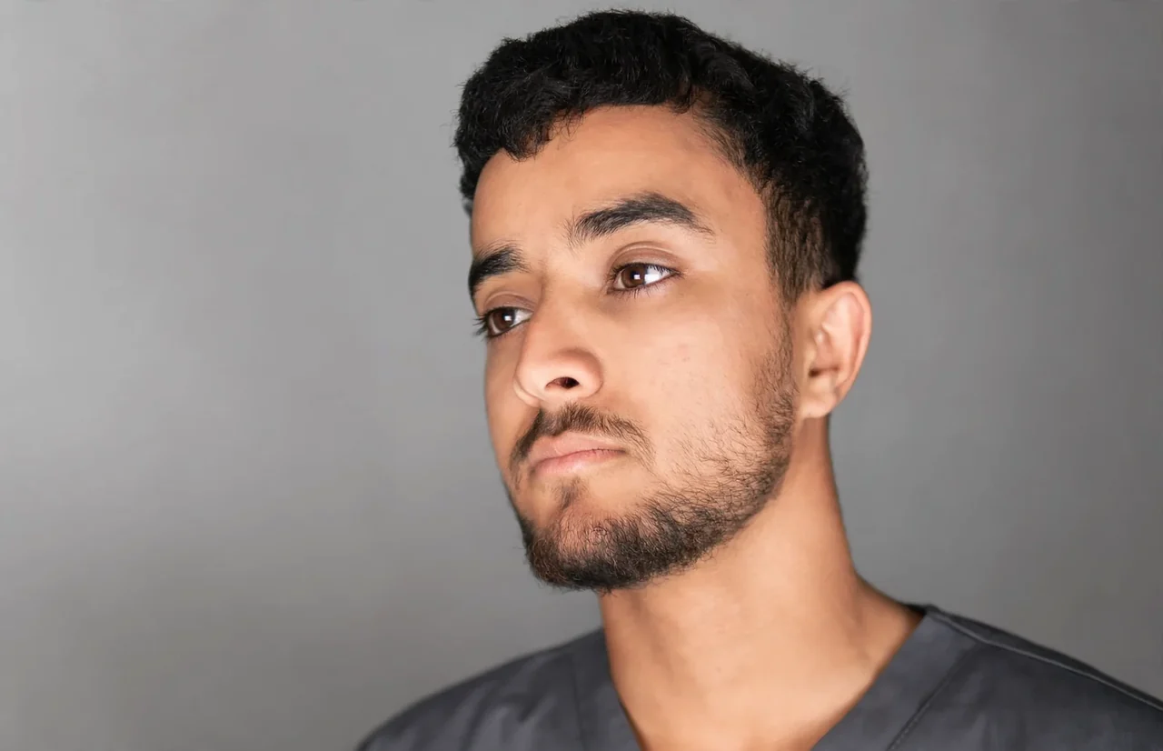 Before: Beard transplant · density