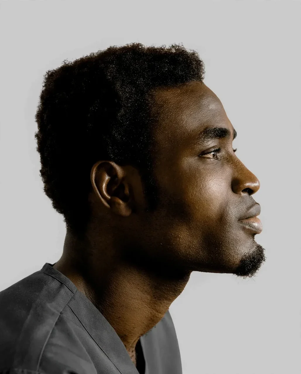 After: Chin filler · men · profile