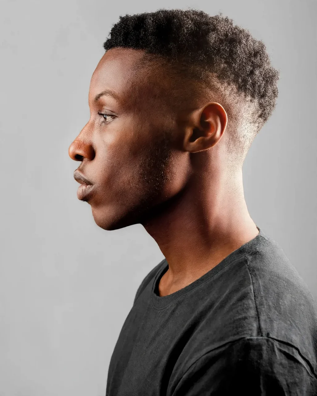 After: Chin implant · profile