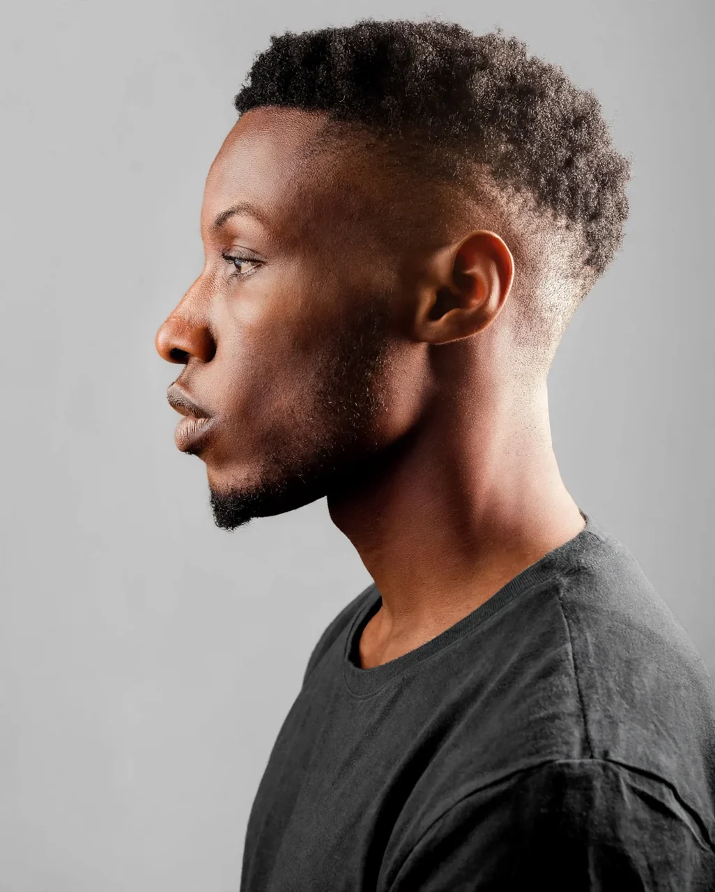Before: Chin implant · profile
