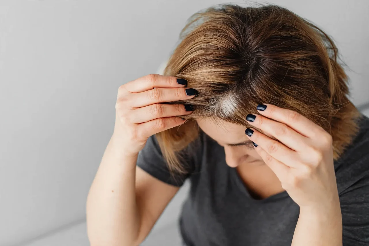Before: Female hair loss · crown