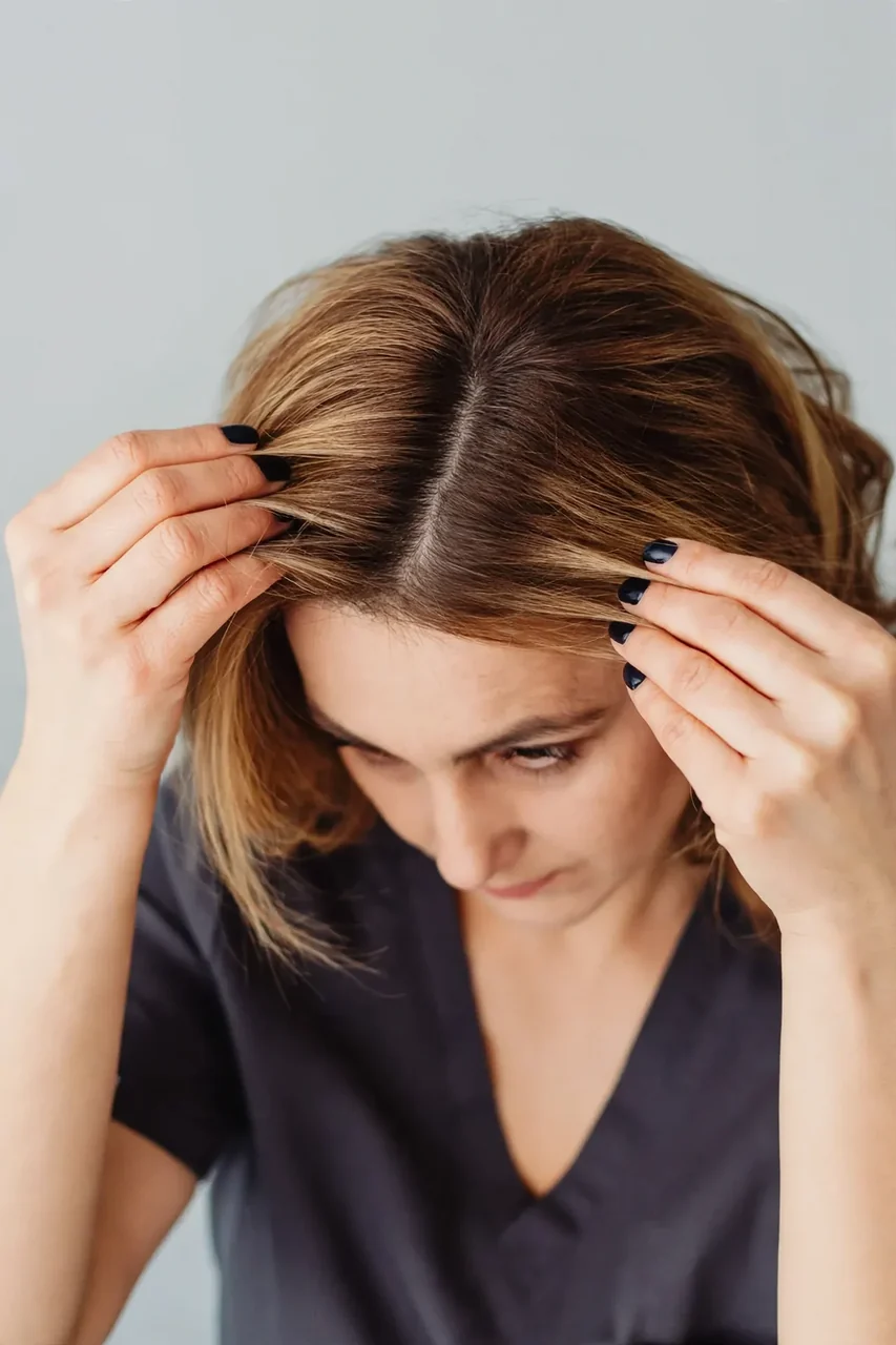 After: Female hair loss · part line