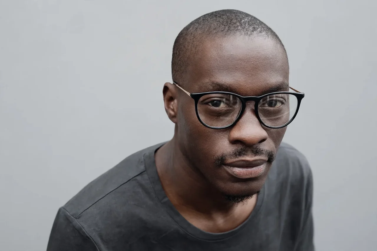 Before: Hair transplant · front hairline