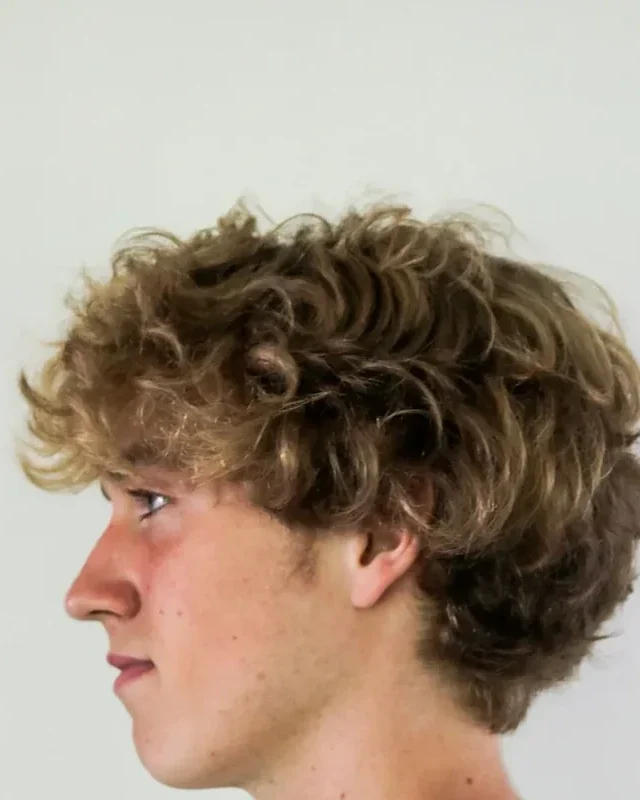 Before: Lip filler · men · 0.5 ml