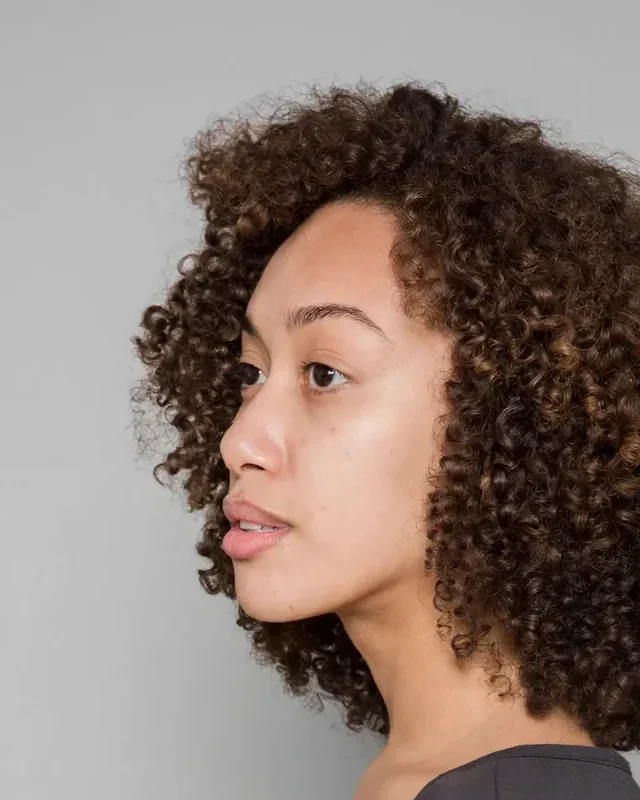 Before: Lip filler at different amounts