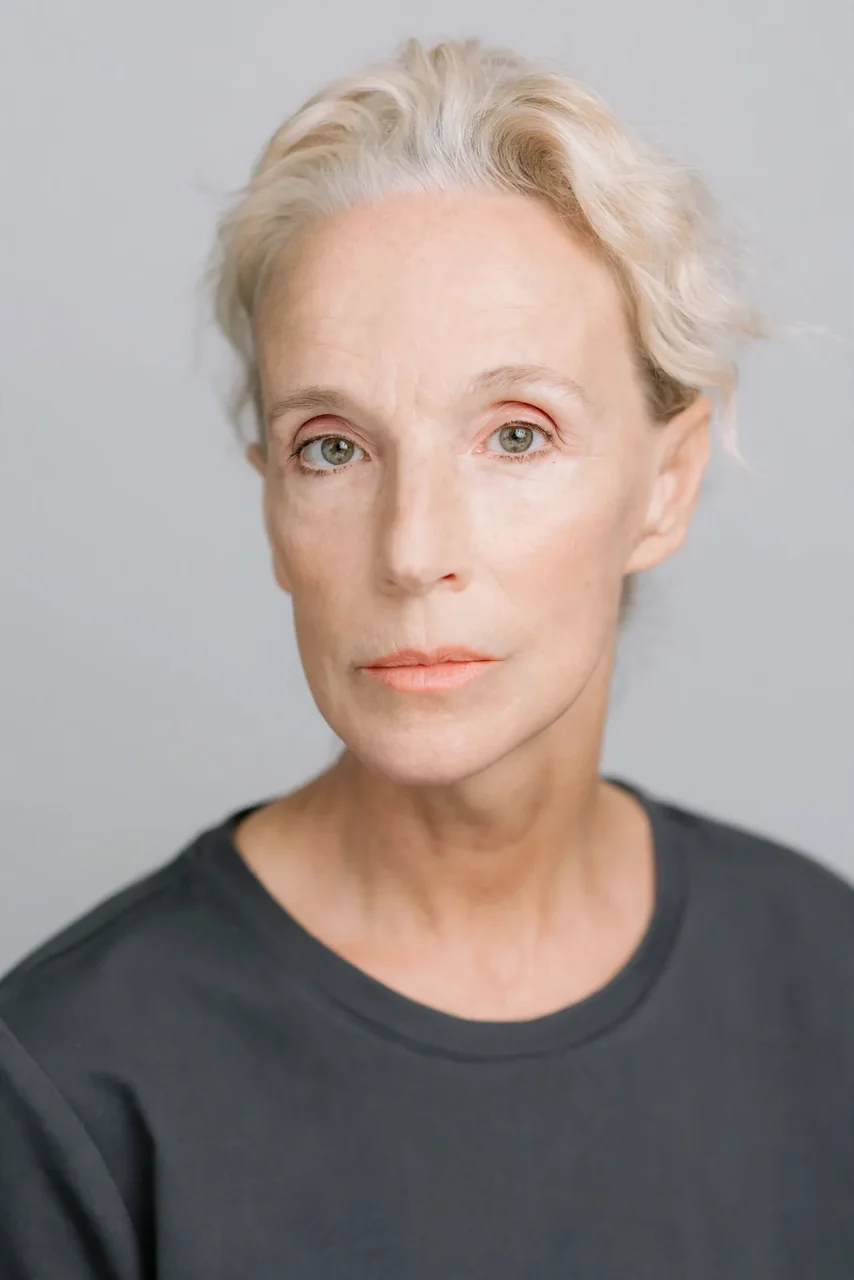 Before: Lip filler · over 50 · lip lines